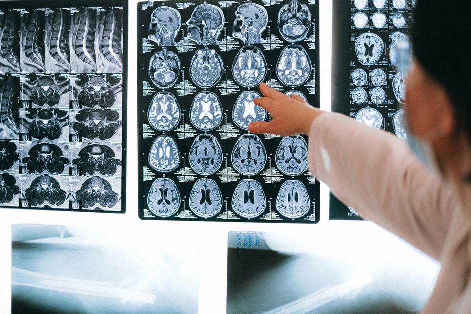 board certified physician examining diagnostic imaging scans